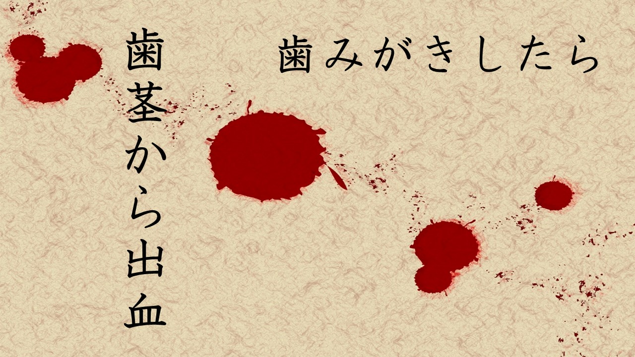 歯みがき時 出血するのって大丈夫 兼松歯科医院